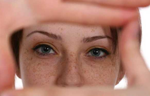 青岛皮肤病医院#小心8个因素导致黄褐斑的发生和加重