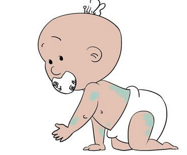 防止宝宝生有胎记这3种行为应避免-青岛皮肤病医院